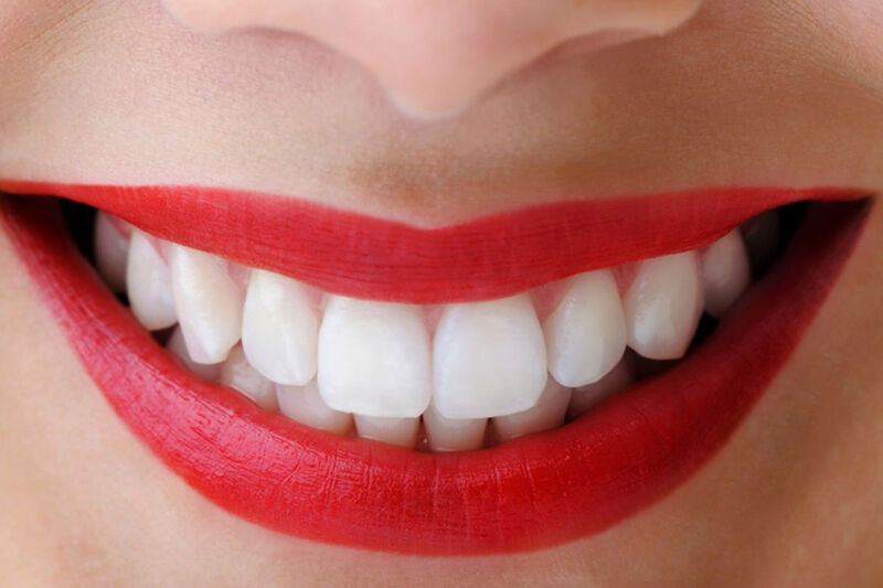 Как вернуть деньги за некачественные стоматологические услуги